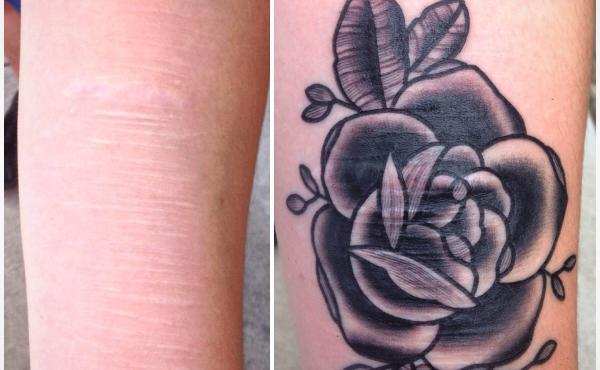 Maddie Keating shows her arm before and after her tattoo by Brian Finn which covered her scars. Maddie Keating shows her arm before and after her tattoo by Brian Finn which covered her scars.
