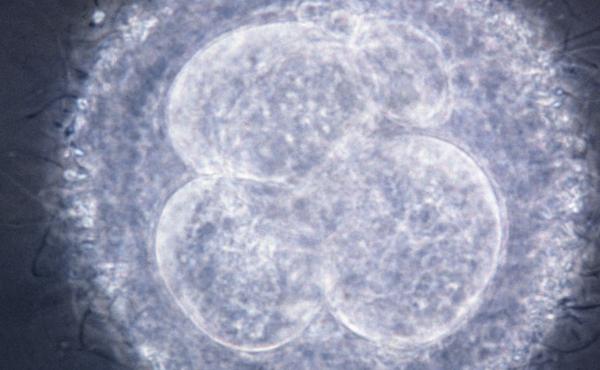 A light micrograph of a primitive human embryo, composed of four cells, following the initial mitotic divisions that ultimately transform a single-cell organism into one composed of millions of cells. A light micrograph of a primitive human embryo, composed of four cells, following the initial mitotic divisions that ultimately transform a single-cell organism into one composed of millions of cells.