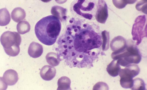 This photomicrograph depicts Leishmania donovani parasites contained within a canine bone marrow cell. One of the more dangerous of 20 different species of Leishmania, L. donovani is endemic to parts of India, Africa, and South-West Asia. This photomicrograph depicts Leishmania donovani parasites contained within a canine bone marrow cell. One of the more dangerous of 20 different species of Leishmania, L. donovani is endemic to parts of India, Africa, and South-West Asia.