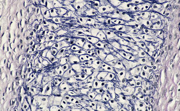 Human fetal tissue (stock photo) Human fetal tissue (stock photo)