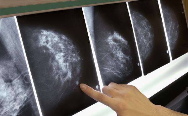 The out-of-pocket expense of mammograms, MRIs and other tests and treatments can be several thousand dollars each year when you have a high-deductible health policy. The out-of-pocket expense of mammograms, MRIs and other tests and treatments can be several thousand dollars each year when you have a high-deductible health policy.