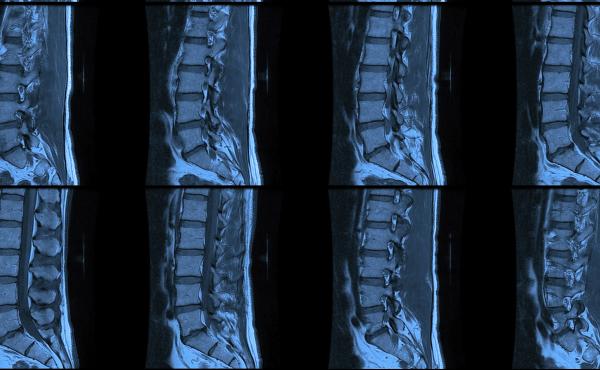 In 49 U.S. states, spotting the squished disc in this spinal MRI is still much easier than learning the price of the MRI in advance. In 49 U.S. states, spotting the squished disc in this spinal MRI is still much easier than learning the price of the MRI in advance.