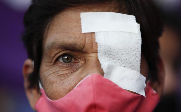 A woman has one eye covered to protest against gender violence, in Buenos Aires, Argentina, Wednesday, Feb. 17, 2021. Women from the "Ni Una Menos" or "Not One Less" movement marched to protest what they say is the negligence of judges when it comes to ta A woman has one eye covered to protest against gender violence, in Buenos Aires, Argentina, Wednesday, Feb. 17, 2021. Women from the "Ni Una Menos" or "Not One Less" movement marched to protest what they say is the negligence of judges when it comes to ta