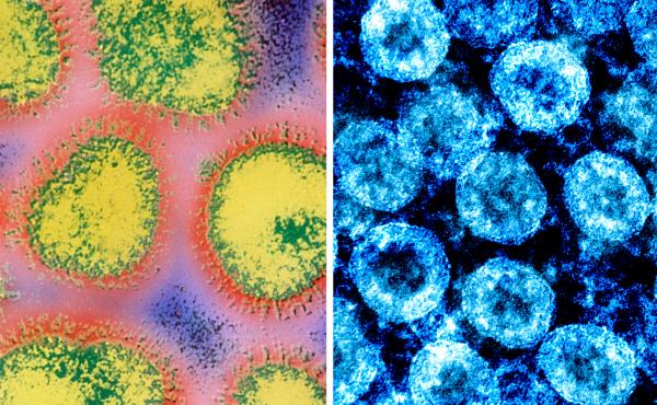 At left: a colorized electron micrograph image of the influenza virus. At right: color-enhanced electron micrograph image of SARS-CoV-2 virus particles, isolated from a patient. At left: a colorized electron micrograph image of the influenza virus. At right: color-enhanced electron micrograph image of SARS-CoV-2 virus particles, isolated from a patient.