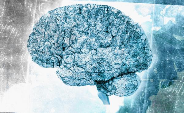 Various forms of dementia can take very different courses, so it's important to get the right diagnosis. Various forms of dementia can take very different courses, so it's important to get the right diagnosis.