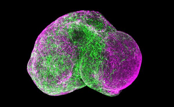 Scientists placed two clusters of cultured forebrain cells side by side (each cluster the size of a head of a pin). Within days, the "minibrains" had fused and particular neurons (in green) migrated from the left side to the right side, as subsets of cell Scientists placed two clusters of cultured forebrain cells side by side (each cluster the size of a head of a pin). Within days, the "minibrains" had fused and particular neurons (in green) migrated from the left side to the right side, as subsets of cell