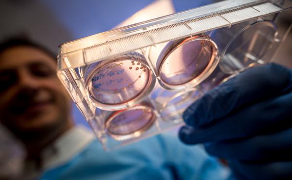 University of California, San Diego scientist Alysson Muotri's lab grew brain organoids from human stem cells that swapped a developmental gene from Neanderthals for the human version. University of California, San Diego scientist Alysson Muotri's lab grew brain organoids from human stem cells that swapped a developmental gene from Neanderthals for the human version.