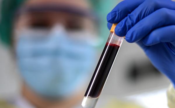 Scientists have studied the blood of people who were part of a large trial for the Moderna vaccine to measures antibodies that can help predict levels of immunity after getting a COVID-19 shot. Scientists have studied the blood of people who were part of a large trial for the Moderna vaccine to measures antibodies that can help predict levels of immunity after getting a COVID-19 shot.