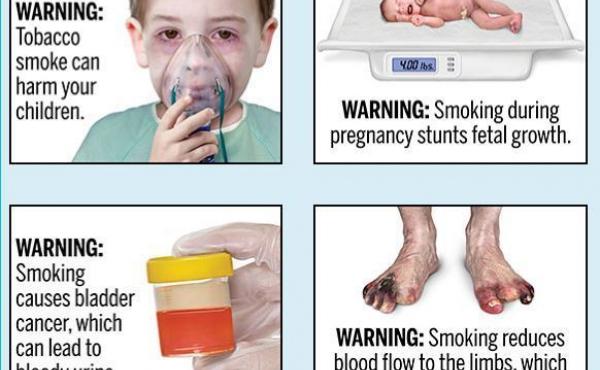The U.S. Food and Drug Administration plans to require tobacco companies to include 13 health warnings on cigarette packaging and advertisements. The U.S. Food and Drug Administration plans to require tobacco companies to include 13 health warnings on cigarette packaging and advertisements.