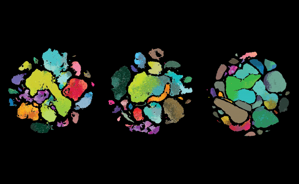 Scientists at the Allen Institute for Brain Science uncovered differences among human brain cells (left) those of the marmoset monkey (middle) and mouse in a brain region that controls movement, the primary motor cortex. Scientists at the Allen Institute for Brain Science uncovered differences among human brain cells (left) those of the marmoset monkey (middle) and mouse in a brain region that controls movement, the primary motor cortex.
