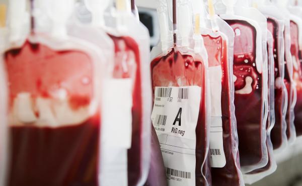Postpartum hemorrhage is the leading cause of maternal deaths around the world. Postpartum hemorrhage is the leading cause of maternal deaths around the world.