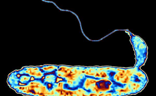 It's a bacteria-eat-bacteria world, scientists say. Bdellovibrio bacteriovorus, shown here in false color, attacks common germs six times its size, then devours them from the inside out. It's a bacteria-eat-bacteria world, scientists say. Bdellovibrio bacteriovorus, shown here in false color, attacks common germs six times its size, then devours them from the inside out.