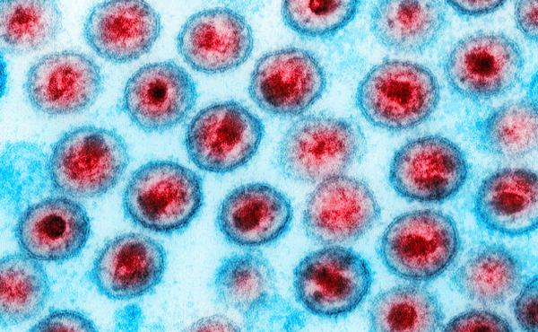 A computer-enhanced image of the HIV virus. A computer-enhanced image of the HIV virus.