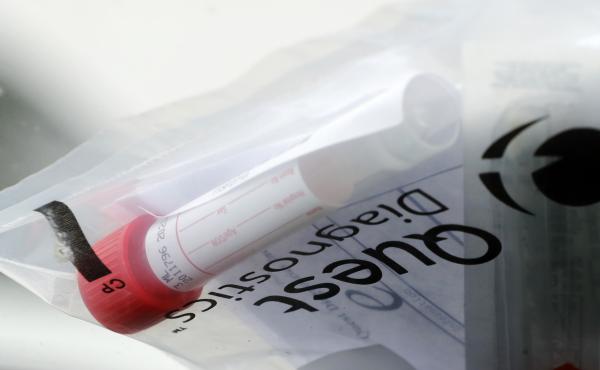 A testing kit sits on the windshield of a car as it passes through a drive-through COVID-19 testing site set up in St. Charles, Mo. A testing kit sits on the windshield of a car as it passes through a drive-through COVID-19 testing site set up in St. Charles, Mo.