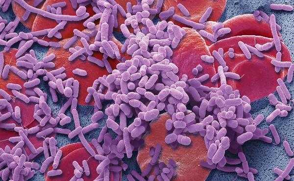 Bacteria (purple) in the bloodstream can trigger sepsis, a life-threatening illness. Bacteria (purple) in the bloodstream can trigger sepsis, a life-threatening illness.