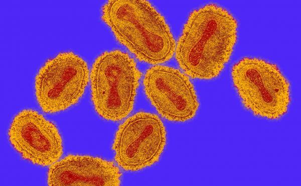 Modern tools of biology could allow someone to recreate a dangerous virus, such as smallpox, from scratch. Modern tools of biology could allow someone to recreate a dangerous virus, such as smallpox, from scratch.