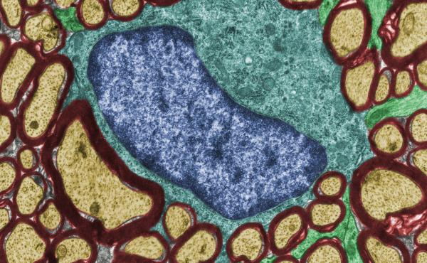 This image from an electron microscope shows a cross-sectional view of an oligodendrocyte (blue) among nerve fibers coated with myelin (dark red). In models of autism spectrum disorder, oligodendrocytes appear to create too much or too little myelin. This image from an electron microscope shows a cross-sectional view of an oligodendrocyte (blue) among nerve fibers coated with myelin (dark red). In models of autism spectrum disorder, oligodendrocytes appear to create too much or too little myelin.