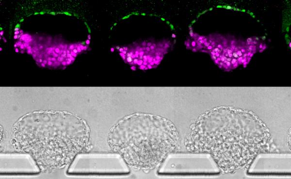 These human embryo-like structures (top) were synthesized from human stem cells; they've been stained to illustrate different cell types. Images (bottom) of the "embryoids" in the new device that was invented to make them. These human embryo-like structures (top) were synthesized from human stem cells; they've been stained to illustrate different cell types. Images (bottom) of the "embryoids" in the new device that was invented to make them.