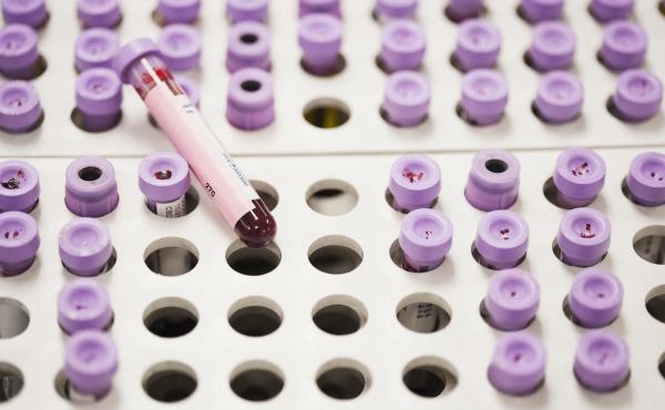 Researchers have identified waves of proteins in blood that peak at three distinct stages of life. What do the findings mean for aging? Researchers have identified waves of proteins in blood that peak at three distinct stages of life. What do the findings mean for aging?