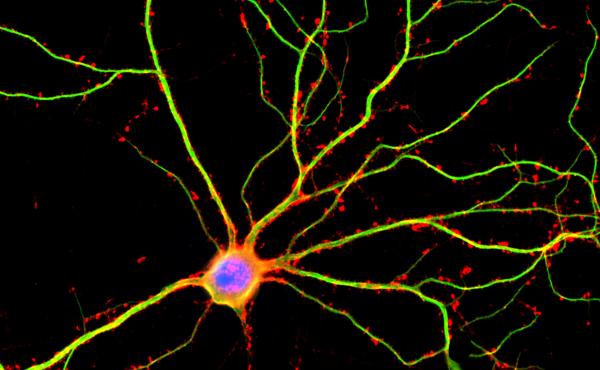 A hippocampal neuron seen in culture. Dendrites are green, dendritic spines are red and DNA is blue. A hippocampal neuron seen in culture. Dendrites are green, dendritic spines are red and DNA is blue.