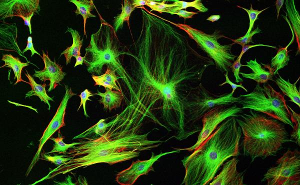 Astrocyte cells like these from the brain of a mouse may differ subtly from those in a human brain. Astrocyte cells like these from the brain of a mouse may differ subtly from those in a human brain.