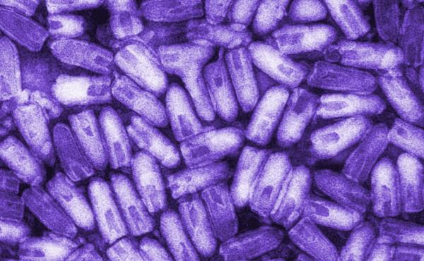 The infectious and contagious rabies virus, shown here in a colorized micrograph, can be transmitted to humans through the bite or saliva of an infected animal. Thanks to protective vaccination of pets, rabies was eliminated from the U.S. dog population i The infectious and contagious rabies virus, shown here in a colorized micrograph, can be transmitted to humans through the bite or saliva of an infected animal. Thanks to protective vaccination of pets, rabies was eliminated from the U.S. dog population i