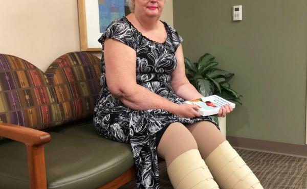 Marlene Simpson of Sacramento, Calif., wears compression bandages daily to help reduce the swelling in her legs. She is getting fitted for compression bandages for her arms to prevent swelling there. Marlene Simpson of Sacramento, Calif., wears compression bandages daily to help reduce the swelling in her legs. She is getting fitted for compression bandages for her arms to prevent swelling there.
