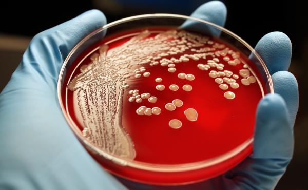 Scientists are exploring new drugs that can fight antibiotic-resistant bacteria such as MRSA. Scientists are exploring new drugs that can fight antibiotic-resistant bacteria such as MRSA.