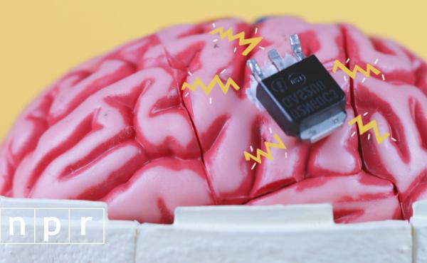 an image of a computer chip on a model human brain an image of a computer chip on a model human brain