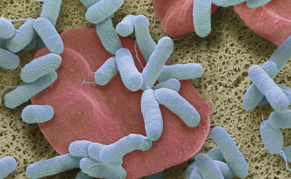 Sepsis, or blood poisoning, occurs when the body overreacts to infection. It's a leading cause of death worldwide. Sepsis, or blood poisoning, occurs when the body overreacts to infection. It's a leading cause of death worldwide.