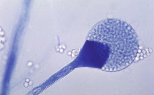 A light micrograph of a mature sporangium of a mucor fungus. India is seeing a rise in cases of mucormycosis, a rare but dangerous fungal infection. A light micrograph of a mature sporangium of a mucor fungus. India is seeing a rise in cases of mucormycosis, a rare but dangerous fungal infection.