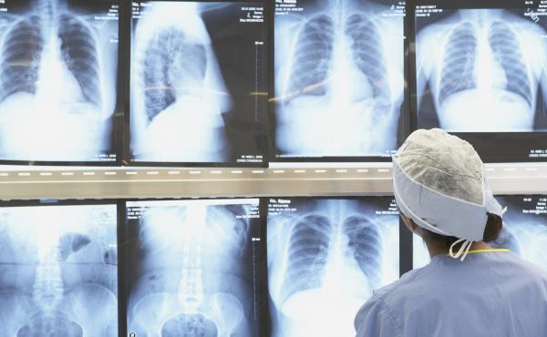 Some medical tests, such as MRIs done early for uncomplicated low back pain and routine vitamin D tests "just to be thorough," are considered "low-value care" and can lead to further testing that can cost patients thousands of dollars. Some medical tests, such as MRIs done early for uncomplicated low back pain and routine vitamin D tests "just to be thorough," are considered "low-value care" and can lead to further testing that can cost patients thousands of dollars.