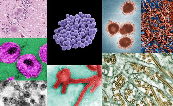 Do you know what the deadliest disease is? Hint: It's not Ebola (viral particles seen here in a digitally colorized microscopic image, at top right, along with similar depictions of other contagious diseases) Do you know what the deadliest disease is? Hint: It's not Ebola (viral particles seen here in a digitally colorized microscopic image, at top right, along with similar depictions of other contagious diseases)