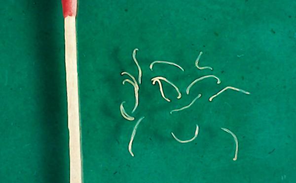 Adult hookworms from a dog. The larvae, which penetrate the skin, are even smaller. Adult hookworms from a dog. The larvae, which penetrate the skin, are even smaller.