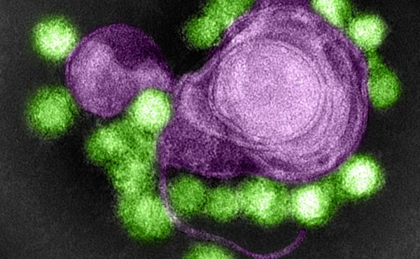 A strain of the Zika virus is stained green in this image from a transmission electron microscope. The virus sample came from a microcephaly case in Brazil. A strain of the Zika virus is stained green in this image from a transmission electron microscope. The virus sample came from a microcephaly case in Brazil.