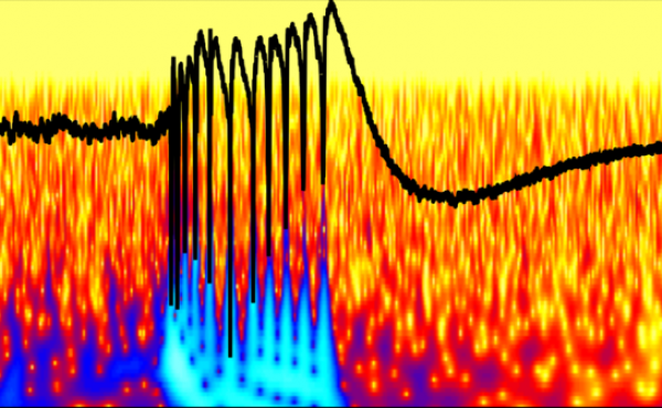 Stop light in your brain A peak of abnormal epileptic brain activity in a brain's hippocampus