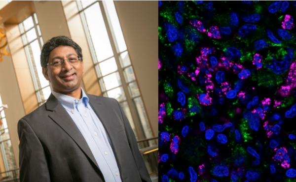 Left: Ravi Bellamkonda, Vinik Dean of the Pratt School of Engineering at Duke University Right:A fluorescent stained image of a tumor marking bacterial nanocarriers in pink, cancer cell nuclei in blue, and human mitochondria (another indicator of tumor c